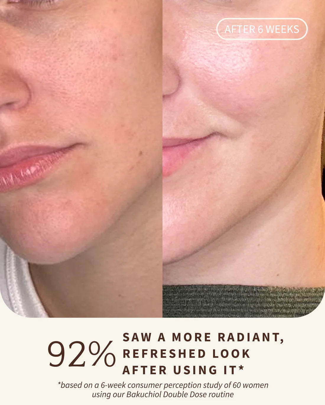 Bakuchiol Peptide Moisturizer